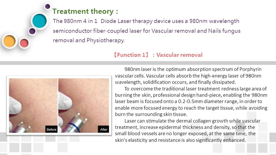 Weifang Laser Diodo 980 Vascular Diode Laser 980 Nm Laser Vascular Removal Machine