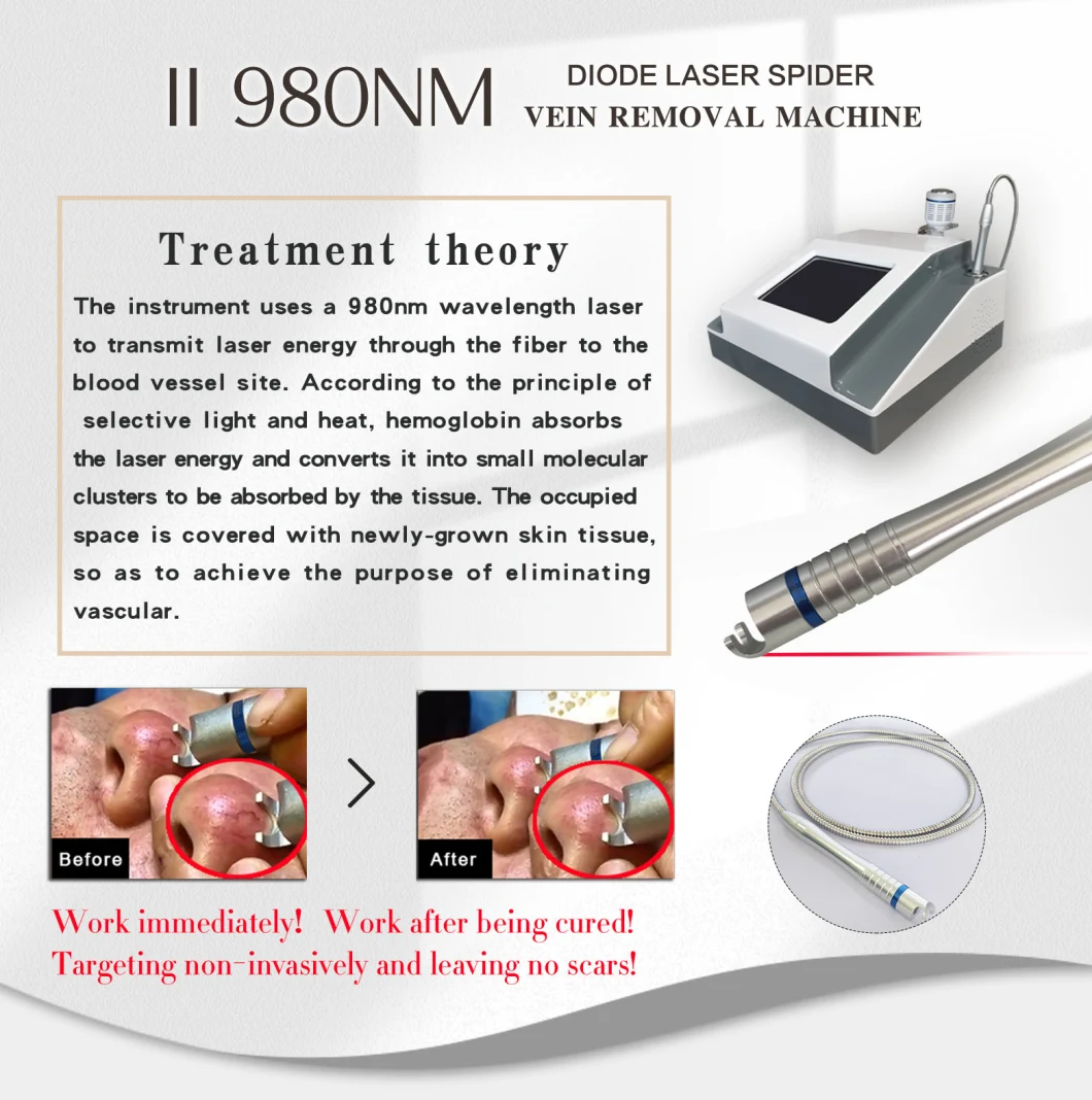 Newest Professional High Power Lce Hammer 980 Nm Diode Laser Physiotherapy Treatment Rbs Spider Vein Vascular Removal Machine Beauty Salon Equipment